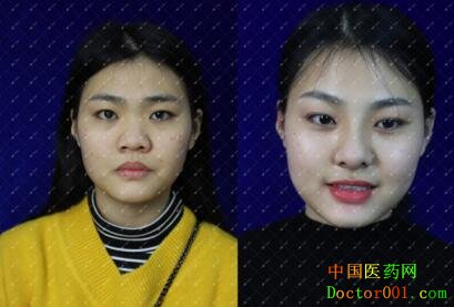 1530952760200456.jpg 李丹琪1.jpg