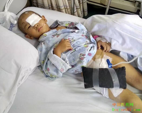 上海双绘义眼免费为苦命孩子定制义眼片 上海双绘义眼免费为苦命孩子定制义眼片
