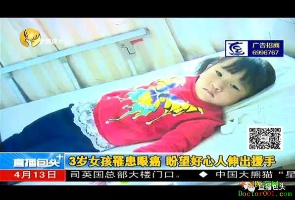 上海双绘义眼免费为苦命孩子定制义眼片 上海双绘义眼免费为苦命孩子定制义眼片