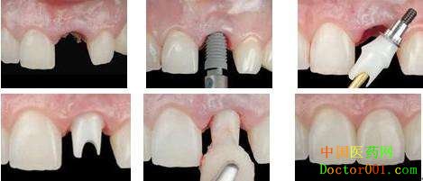 1538097326613787.jpg 0009.jpg