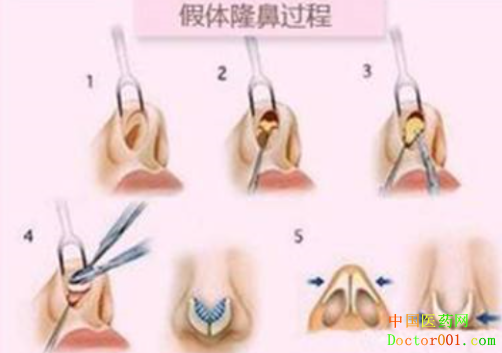 1539249320880432.png Q2(6T`(@)66XVKPGKOZQQJ7.png