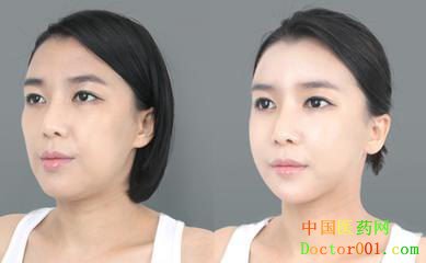 乌鲁木齐华美整形美容医院专业吗?改变自己