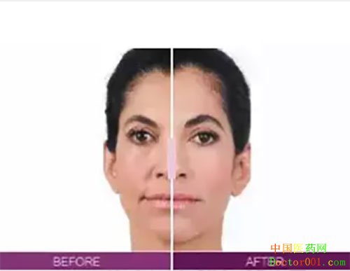 1541671867663896.jpg 4.jpg