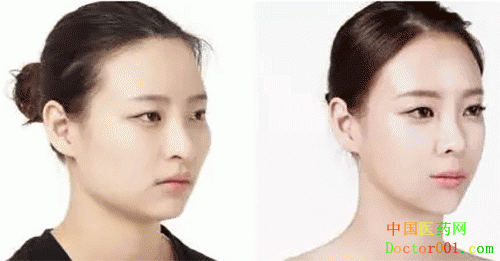 1543393296300262.gif 2.gif