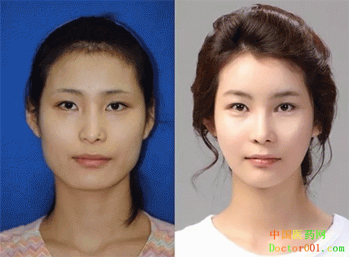 1543393311376578.gif 3.gif