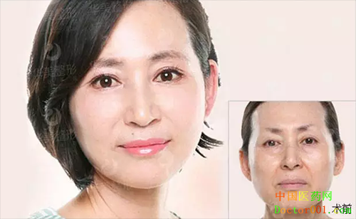 1544174048698512.png 3.png