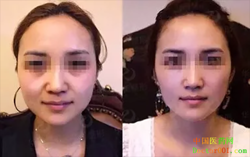 1544174028419993.png 4.png