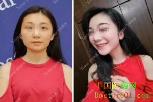 1544765573163944.png QQ截图20181123170307.png