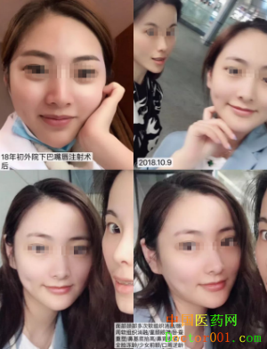 1544765544367492.png QQ截图20181123125722.png