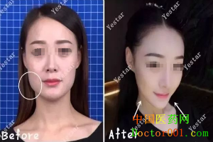 1544765568457167.png QQ截图20181123170231.png