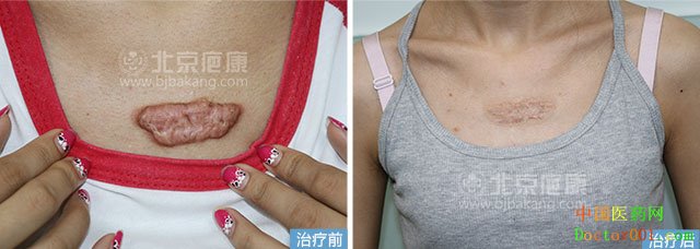 1545025947408892.jpg 东琪美卉对比图 拷贝.jpg