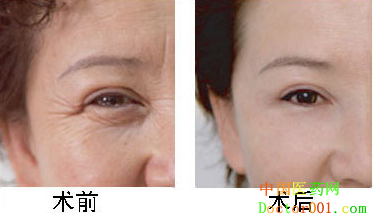 1546410131392885.png QQ图片20190102141554.png