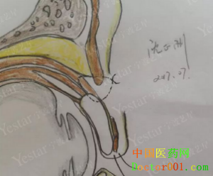 1546838983775771.png QQ截图20181124091440.png