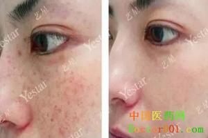 1546837266660041.png QQ截图20181123170307.png