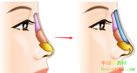 1552642217796901.png 1H3223445-0.png