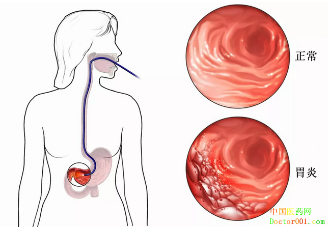 1552901072989316.png image.png