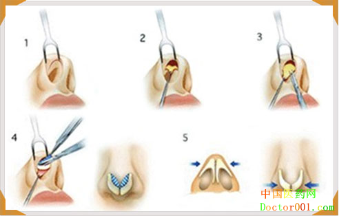 aaf14f28ad56426a8ca06a3ed7c95958_th (1).png