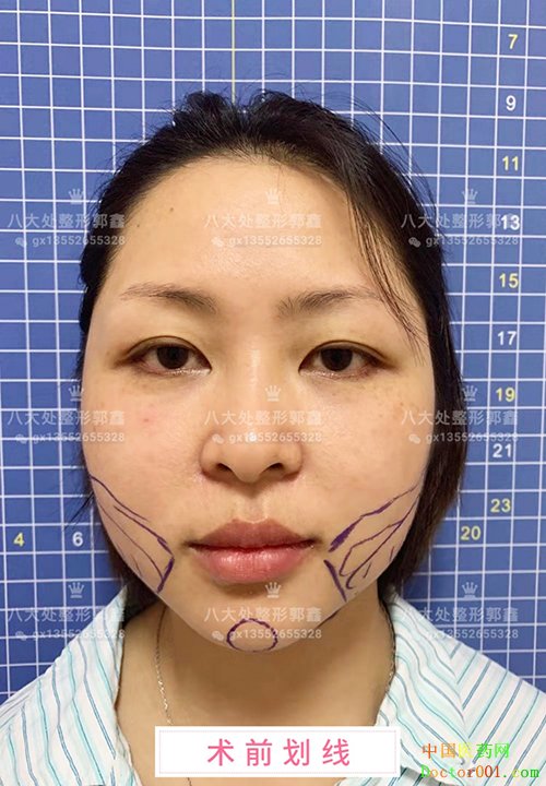 1565665001592844.jpg 0YYBAF1DzOqAKlg6AATGNmKIfZk687.jpg