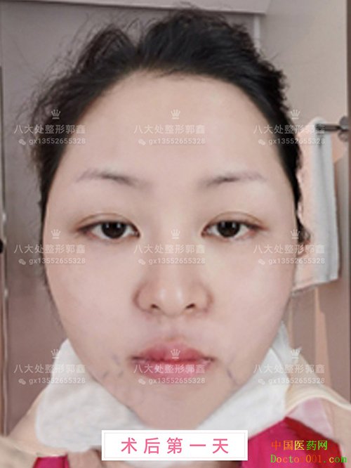 1565665026641302.jpg 0YYBAF1DzNyAGYmRAAJVTU_1B1U549.jpg