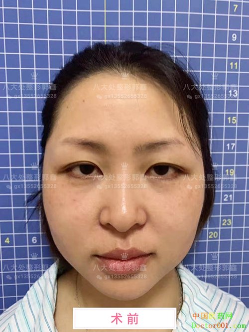 1565664981955739.jpg 0YYBAF1DzJyAcOeFAAPIipYQpQw734.jpg