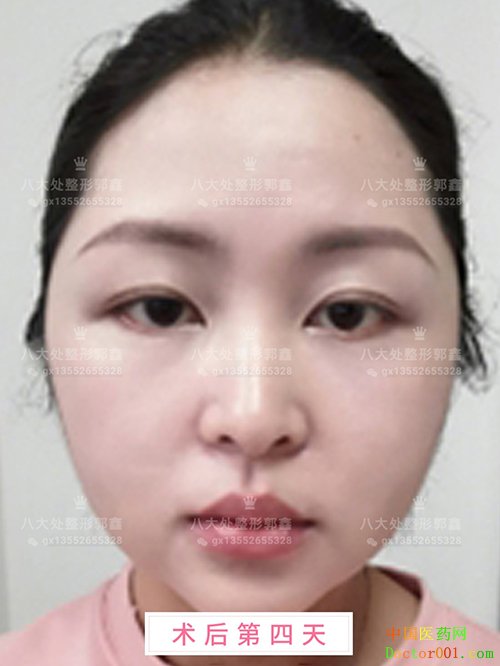 1565665061642976.jpg zIYBAF1Dz72ALc1dAAIU5WYwoU4815.jpg