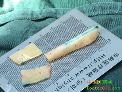 1567907743911710.png blob.png