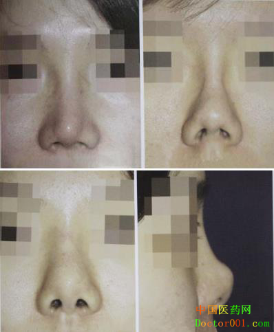 1567907749147195.png blob.png