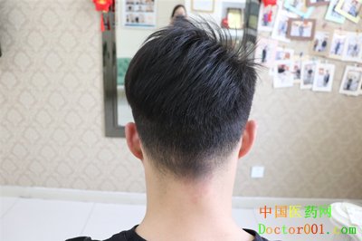 1569581504625608.jpg 术后2年 (6)_副本.jpg