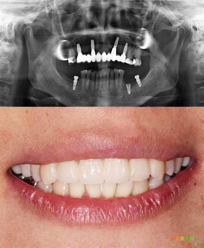 1569571659498327.jpg QQ图片20190927144425.jpg