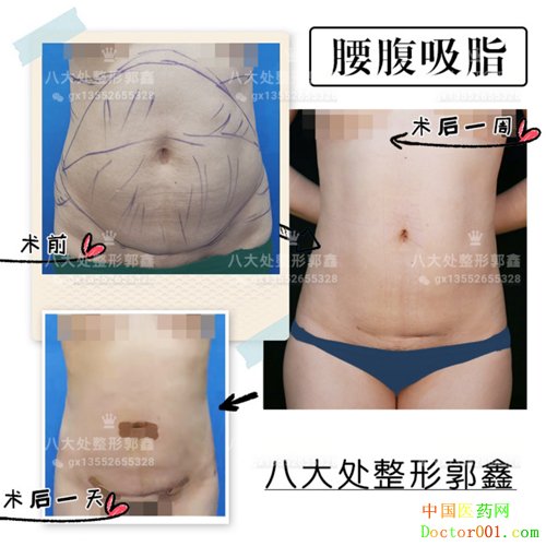 1570607029392275.jpg a4bf80f6gy1g6pmi2dpeaj20j61eu777.jpg