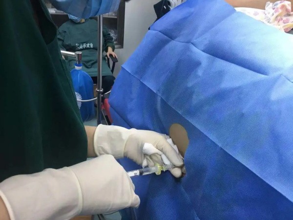 1637886487174918.jpg 麻醉.jpg